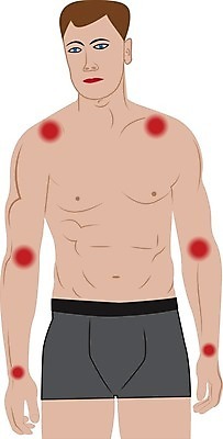 EPS 해외이미지 남자 스포츠 과학 백그라운드 신체 일러스트 해부 근육 건강 사람 치료 약 고통 의사 흰색 대접 질병 상처 하락 사건 손목 어깨 관절염 문제 팔 무거움 외과 테라피 돌봄 압축 연골 증상 팔꿈치 해외202004 해외일러스트 감정 컬러 컨셉 의학 모션 병원 신체부위 뷰티 의료진 무게 파일형식 벡터 이미지허브