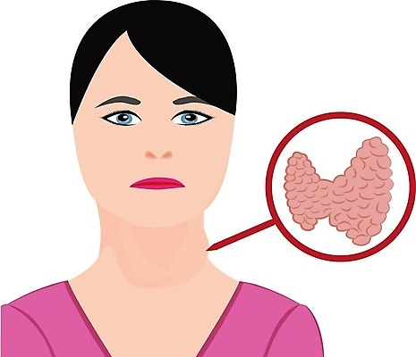 EPS 해외이미지 여자 일러스트 해부 건강 사람 약 흰색 오르간 질병 큼 시스템 목 돌봄 염증 증상 호르몬 해외202004 해외일러스트 컬러 의학 모션 신체부위 건반악기 크기 파일형식 벡터 이미지허브