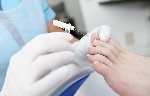 포토 JPG 해외이미지 손 발 사람없음 치료 기구 칼 닫기 손톱 피부 발가락 돌봄 라텍스 위생관리 페디큐어 해외202004 해외포토 의학 모션 관리 신체부위 뷰티 파일형식 이미지허브