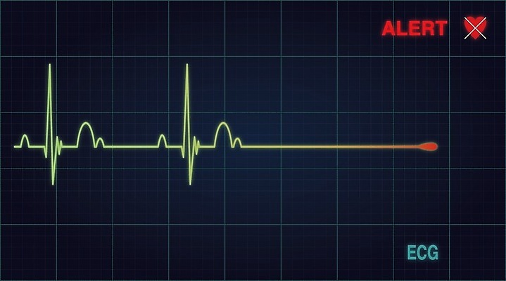 EPS 해외이미지 모양 선 컨셉 일러스트 그래프 건강 경고 그래픽 파란색 빛 컴퓨터 건강관리 디지털 스크린 모니터 장비 하트 심장 긴급 죽음 플랫 맥박 공격 속도 전자 공포 서명 빛망울 경보 그만 바이탈 심전도 위기 체포 픽셀 해외202004 해외일러스트 컬러 의학 모션 관리 전자제품 장기_의학 파일형식 벡터 이미지허브