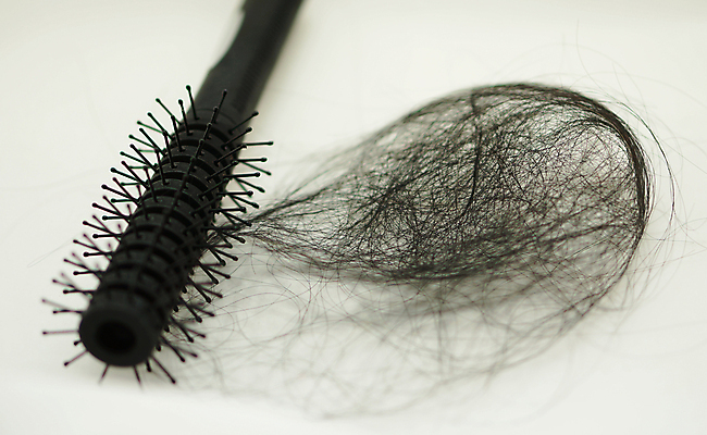 포토 JPG 해외이미지 사람없음 뷰티 머리카락 머리빗 소프트포커스 흰배경 두피케어 탈모 탈모클리닉 해외202004 탈모예방 해외포토 백그라운드 촬영기법 머리 흰색 미용용품 예방 클리닉 헤어관리 증상 파일형식 이미지허브