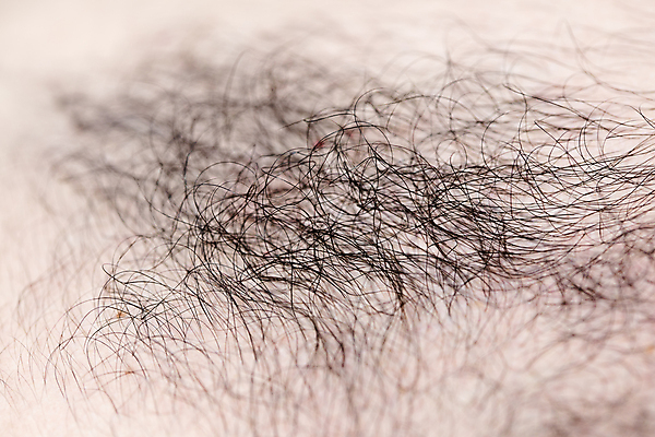 포토 JPG 해외이미지 남자 뷰티 머리카락 대머리 두피 두피관리 두피케어 탈모 탈모클리닉 해외202004 탈모예방 해외포토 헤어스타일 사람 머리 예방 클리닉 헤어관리 증상 파일형식 이미지허브