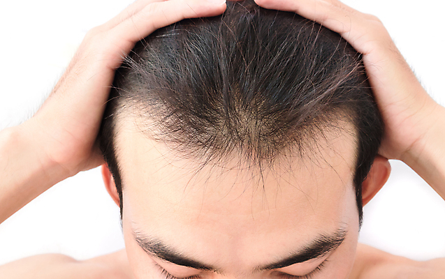 포토 JPG 해외이미지 남자 한명 상반신 성인 뷰티 머리카락 머리 흰배경 두피관리 두피케어 탈모 탈모클리닉 성인남자한명만 해외202004 탈모예방 해외포토 1 백그라운드 사람 신체부위 흰색 예방 클리닉 헤어관리 증상 남자한명만 성인남자만 파일형식 이미지허브