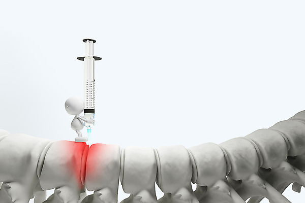 PSD 편집이미지 캐릭터 인형 의학 의료기기 뼈 3D캐릭터 병원 주사기 사람없음 신체부위 그래픽 치료 3D소스 3D 모형 고통 피규어 디스크 의료용품 척추 허리디스크 편집소스 편집3D 감정 사람 미니어처 디스크_질병 질병 디지털합성 파일형식
