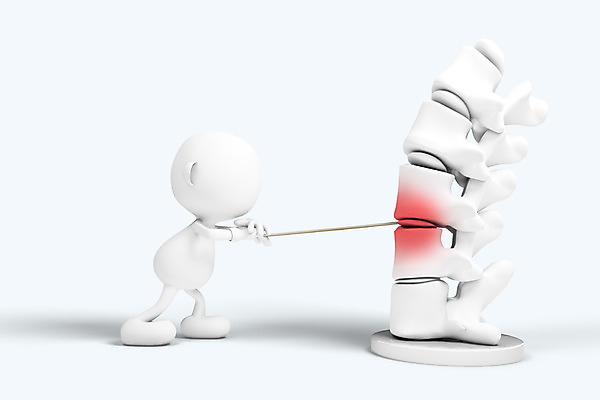 PSD 편집이미지 캐릭터 인형 의학 의료기기 뼈 3D캐릭터 병원 사람없음 신체부위 그래픽 치료 3D소스 3D 모형 고통 피규어 의료용품 막대기 허리 척추 허리디스크 편집소스 편집3D 감정 사람 미니어처 디스크_질병 디지털합성 파일형식