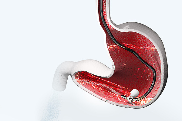 PSD 편집이미지 캐릭터 인형 의학 의료기기 3D캐릭터 병원 사람없음 신체부위 그래픽 치료 물 3D소스 3D 모형 피규어 의료용품 소화기관 장기 청소 위장 편집소스 편집3D 자연요소 신체 사람 미니어처 장기_의학 디지털합성 파일형식