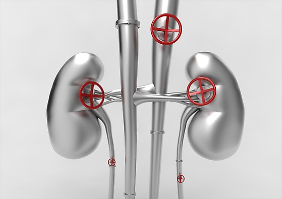 PSD 편집이미지 산업 백그라운드 사람없음 컴퓨터그래픽 그래픽 경제 3D소스 3D 금속 신장 장기 철 파이프 편집소스 편집3D 신체 재질 비뇨기관 디지털합성 파일형식