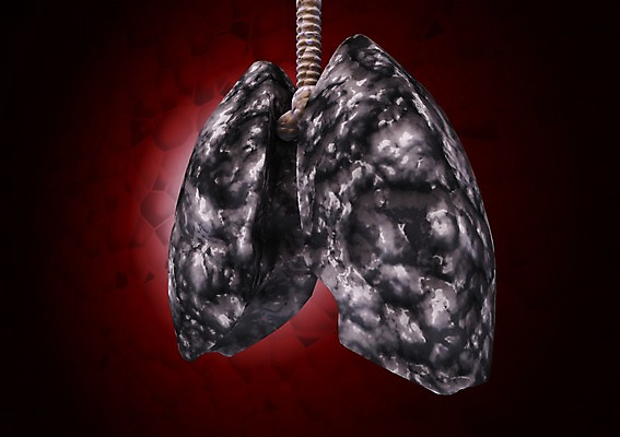 PSD 편집이미지 백그라운드 신체 의학 생명 현미경 사람없음 라이프 컴퓨터그래픽 그래픽 치료 3D소스 3D 돌_바위 조직 질병 생명공학 척추 입체 간 감염 박테리아 썩음 편집소스 편집3D 뼈 실험기구 생활 장기_의학 디지털합성 파일형식