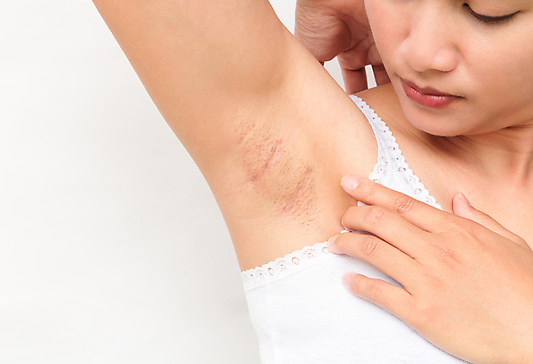 포토 JPG 해외이미지 여자 백그라운드 신체 건강 한명 사람 성인 검은색 어둠 젖음 흰색 신선 주름 피부 땀 냄새 문제 팔 데오드란트 돌봄 힘듦 해외202004 해외포토 1 컬러 컨셉 모션 신체부위 파일형식 이미지허브