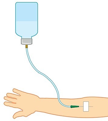 EPS 해외이미지 손 일러스트 건강 병원 주사기 사람 치료 약 의사 액체 컨테이너 구급차 흰배경 주사약 테라피 물리치료 백신 투입 헬프 해외202004 해외일러스트 산업 백그라운드 의학 의료기기 모션 자동차 신체부위 뷰티 의료진 흰색 도움 파일형식 벡터 이미지허브