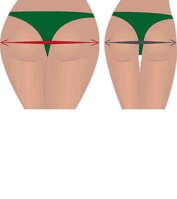 EPS 해외이미지 모양 라이프스타일 여자 스포츠 신체 다이어트 일러스트 건강 운동 숫자 흰색 수술 몸무게 큼 엉덩이 비만 날씬함 허리 연습 당나귀 외과 돌봄 얇은 적자 해로움 셀룰라이트 해외202004 해외일러스트 동물 문자 컬러 컨셉 의학 모션 병원 사람 생활 신체부위 말 크기 몸매 파일형식 벡터 이미지허브
