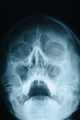 포토 JPG 해외이미지 교육 얼굴 과학 해부 사람없음 머리 건강관리 검은색 뇌 생물학 지능 터키석 해골모형 해외202004 해외포토 컬러 의학 건강 관리 신체부위 모형 보석 파일형식 이미지허브