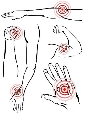 EPS 해외이미지 손 남자 스포츠 신체 일러스트 해부 근육 뼈 스트레스 고통 시험 환자 혈액 손목 어깨 관절염 골다공증 팔 외과 골절 부담 연골 칼슘 해외202004 해외일러스트 교육 감정 의학 병원 사람 신체부위 질병 파일형식 벡터 이미지허브