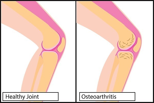 EPS 해외이미지 과학 신체 일러스트 손가락 해부 근육 뼈 골격 건강 종류 사람 약 고통 거친 질병 관절염 무릎 골다공증 테라피 타입 돌봄 면역력 연골 염증 지원 해외202004 해외일러스트 손 감정 의학 모션 신체부위 뷰티 파일형식 벡터 이미지허브