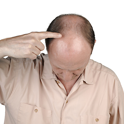 포토 JPG 해외이미지 백인 헤어스타일 남자 부분 손가락 표시 한명 사람 손짓 성인 약 머리 검은색 활발 회색 엄지손가락 흰색 가리킴 피부 대머리 인덱스 보여주기 고립 돌봄 방법 완벽 적자 충고 노화 해외202004 해외포토 서양인 1 손 컬러 컨셉 의학 모션 신체부위 파일형식 이미지허브