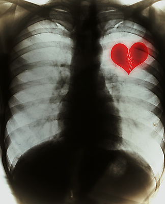 포토 JPG 해외이미지 신체 뼈 골격 엑스레이 건강 병원 사람 동양인 사람없음 검은색 고통 환자 광선 흰색 하트 죽음 투명 실험실 호흡 결과 질병 필름 궤 깨짐 방사선 부정적 천식 해외202004 해외포토 모양 감정 컬러 컨셉 의학 실험 인종 파일형식 이미지허브