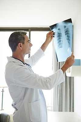 포토 JPG 서양인 외국인 백인 해외기획촬영 직업 라이프스타일 남자 여유 중년 50대 모션 중년라이프 엑스레이 실내 병원 2014년태국 한명 서기 들기 사람 상반신 성인 옆모습 믿음 의사 가운 의사가운 자신감 필름 수술복 열정 남자만 남자한명만 성인남자만 성인한명만 성인남자한명만 중년만 중년남자만 중년남자한명만 성인만 국내포토 1 옷 감정 뷰포인트 의학 인종 내부 생활 의료진 파일형식