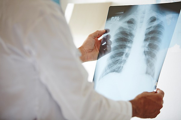 포토 JPG 서양인 외국인 백인 해외기획촬영 직업 라이프스타일 남자 여유 중년 50대 모션 중년라이프 엑스레이 실내 병원 2014년태국 한명 들기 사람 상반신 성인 뒷모습 믿음 진료 의사 가운 의사가운 자신감 수술복 열정 남자만 남자한명만 성인남자만 성인한명만 성인남자한명만 중년만 중년남자만 중년남자한명만 성인만 국내포토 1 옷 감정 뷰포인트 의학 인종 내부 생활 의료진 파일형식