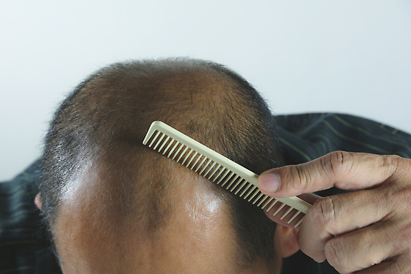 포토 JPG 해외이미지 남자 한명 들기 상반신 성인 뷰티 머리카락 머리 머리빗 흰배경 두피관리 두피케어 탈모 탈모클리닉 성인남자한명만 해외202004 탈모예방 해외포토 1 백그라운드 모션 사람 신체부위 흰색 미용용품 예방 클리닉 헤어관리 증상 남자한명만 성인남자만 파일형식 이미지허브