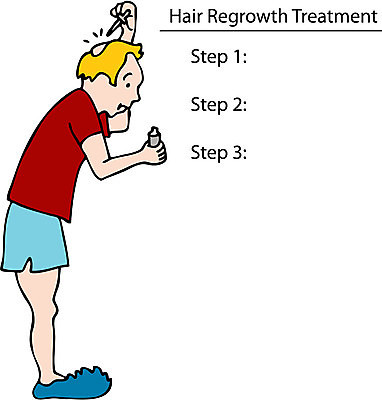 EPS 해외이미지 클립아트 남자 일러스트 슬리퍼 미술 그래픽 치료 약 성장 점 중앙 낙서 속옷 만화 스케치 그림 클립 대머리 탈모 토닉 노화 신청 해외202004 해외일러스트 헤어스타일 옷 신발 컨셉 의학 문화예술 사람 증상 파일형식 벡터 이미지허브
