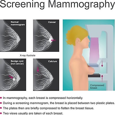 EPS 해외이미지 백인 여자 신체 일러스트 해부 엑스레이 건강 사람 치료 약 스크린 장비 환자 체험 조직 위험 가슴 필름 신호 추천 암 외과 돌봄 방법 방사선 압축 어려움 인구 칼슘 해외202004 해외일러스트 서양인 컨셉 의학 모션 병원 신체부위 질병 파일형식 벡터 이미지허브