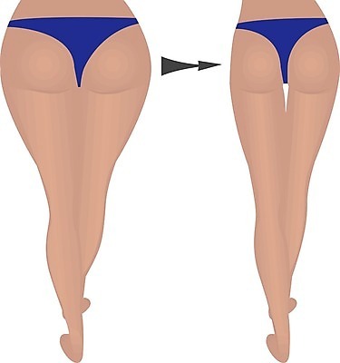 EPS 해외이미지 모양 모델 여자 신체 다이어트 일러스트 건강 사람 숫자 유행 흰색 몸무게 큼 엉덩이 비만 날씬함 문제 당나귀 허벅지 고립 돌봄 적자 전후 셀룰라이트 해외202004 해외일러스트 문자 컬러 모션 신체부위 말_동물 비교 크기 몸매 파일형식 벡터 이미지허브