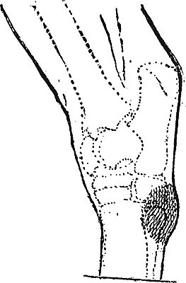 EPS 해외이미지 동물 백그라운드 일러스트 해부 뼈 미술 검은색 수확 골동품 흰색 질병 묘사 그림 판화 고립 변소 부담 옛날 해외202004 해외일러스트 컬러 농업 의학 문화예술 파일형식 벡터 이미지허브