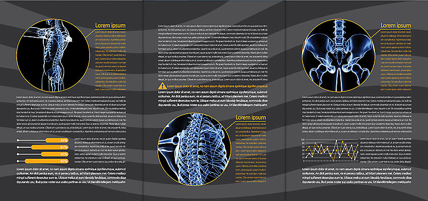 템플릿 편집 표지디자인 북디자인 출판디자인 내지 리플렛 백그라운드 신체 북커버 3단접지 의학 그래프 뼈 엑스레이 팜플렛 사람없음 치료 디스크 척추 골반 정형외과 이미지템플릿 AI파일 병원 질병 파일형식 벡터