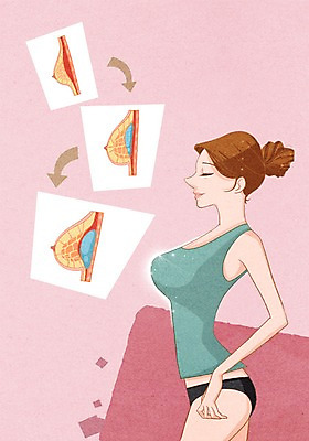 PSD 여자 일러스트 성공 한명 사람 성인 신체부위 뷰티 비교 변화 성형수술 속옷 가슴 만족 가슴성형 여자만 여자한명만 성인여자만 성인만 국내일러스트 1 옷 감정 컨셉 수술 파일형식