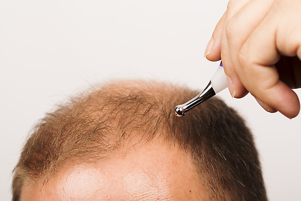 포토 JPG 해외이미지 남자 의료기기 한명 들기 상반신 성인 뷰티 머리카락 흰배경 두피관리 두피케어 탈모 탈모클리닉 성인남자한명만 해외202004 탈모예방 해외포토 1 백그라운드 의학 모션 사람 머리 흰색 예방 클리닉 헤어관리 증상 남자한명만 성인남자만 파일형식 이미지허브