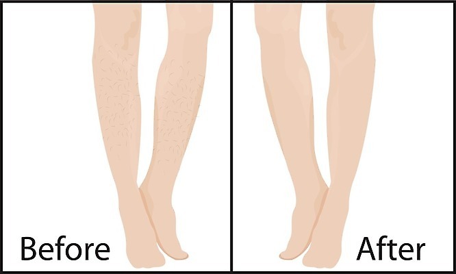 EPS 해외이미지 템플릿 디자인 배너 여자 포스터 신체 일러스트 건강 치료 비키니 상점 화장품 막대기 매끈함 심볼 피부 스킨케어 면도기 순서 삭제 돌봄 바디케어 왁스 위생관리 제모 해외202004 해외일러스트 수영복 의학 모션 관리 사람 신체부위 위생용품 뷰티 감각 파일형식 벡터 이미지허브