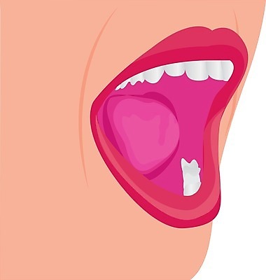 EPS 해외이미지 여자 얼굴 컨셉 일러스트 아침 건강 치과 미소 사람 치료 빨간색 약 신선 도움 입 수비 우아함 치아 보호 씻기 칫솔 플라스틱 혀 입술 오브젝트 그림 치과의사 예방 반죽 치약 문제 순서 돌봄 위생관리 트러블 해외202004 해외일러스트 주간 컬러 의학 모션 재질 표정 병원 관리 신체부위 위생용품 청결 의사 소화기관 파일형식 벡터 이미지허브