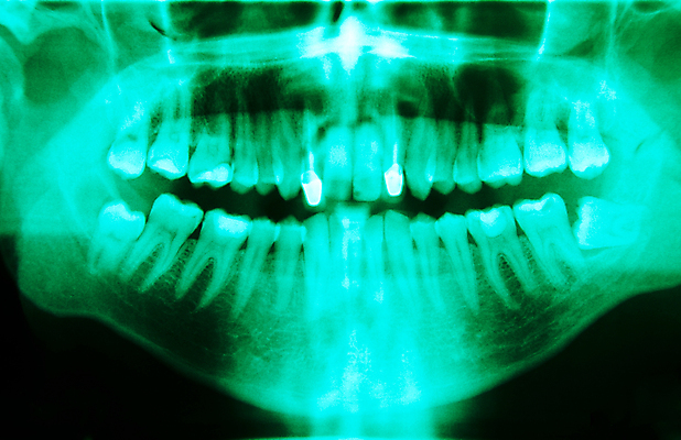 포토 JPG 해외이미지 해부 뼈 엑스레이 파노라마 사람 사람없음 파란색 약 장비 입 치아 질병 가득함 서비스 치과의사 위생관리 해골모형 해외202004 해외포토 컬러 의학 촬영기법 관리 신체부위 모형 의사 소화기관 파일형식 이미지허브