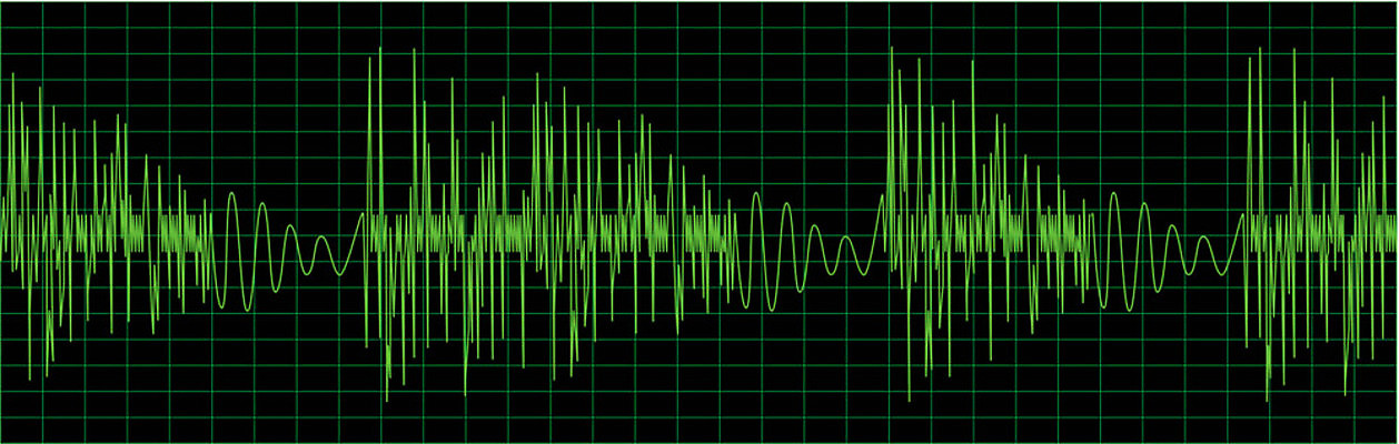 EPS 해외이미지 디자인 선 파도 백그라운드 패턴 일러스트 건강 장식 초록색 빛 약 검은색 샐러드 하트 맥박 계획 그림 네온 리듬 지그재그 해외202004 해외일러스트 모양 음식 바다 컬러 컨셉 무늬 의학 파일형식 벡터 이미지허브