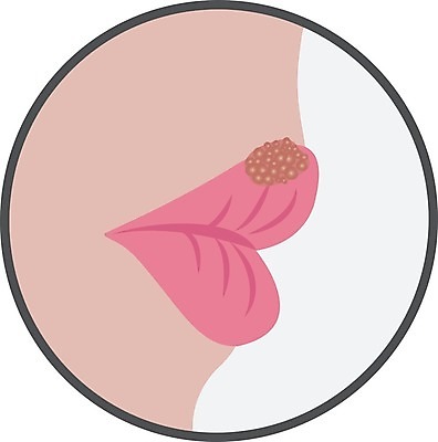 EPS 해외이미지 여자 얼굴 백그라운드 일러스트 건강 사람 치료 약 고통 추위 흰색 열 입 조직 바이러스 질병 입술 감염 전염 문제 알레르기 고립 돌봄 염증 증상 해외202004 구내염 해외일러스트 감정 컬러 의학 모션 신체부위 파일형식 벡터 이미지허브