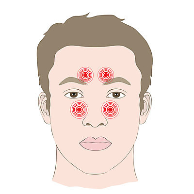 EPS 해외이미지 얼굴 신체 일러스트 해부 건강 사람 치료 약 머리 고통 환자 긴급 대접 질병 위험 공격 약국 두통 감염 문제 불평 증상 화상 해외202004 해외일러스트 감정 컨셉 의학 모션 신체부위 상처 파일형식 벡터 이미지허브