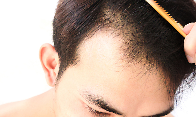 포토 JPG 해외이미지 남자 한명 들기 근접촬영 성인 뷰티 머리카락 머리 머리빗 흰배경 두피관리 두피케어 탈모 탈모클리닉 성인남자한명만 해외202004 탈모예방 해외포토 1 뷰포인트 백그라운드 모션 사람 신체부위 흰색 미용용품 예방 클리닉 헤어관리 증상 남자한명만 성인남자만 파일형식 이미지허브