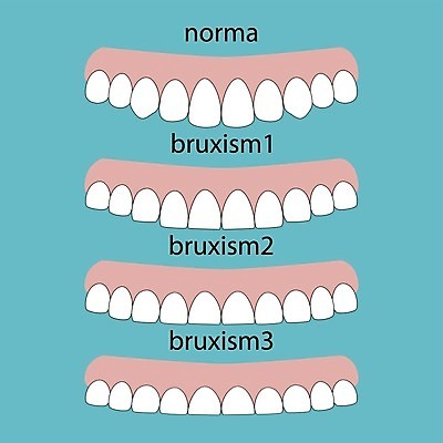 EPS 해외이미지 디자인 배너 얼굴 컨셉 일러스트 설계 건강 치과 병원 미소 성인 치료 약 기계 손상 의사 입 치아 보호 결과 질병 치과의사 레이아웃 약속 파란배경 심플 틀니 돌봄 복원 아크릴 못생김 해외202004 해외일러스트 백그라운드 의학 모션 재질 표정 사람 신체부위 파란색 의료진 소화기관 파일형식 벡터 이미지허브