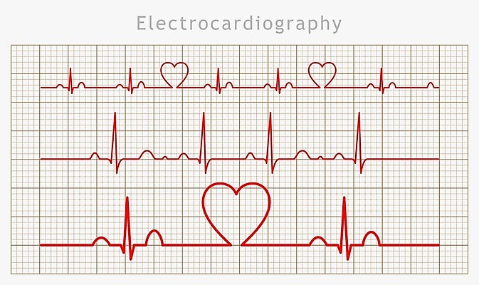 EPS 해외이미지 모양 파도 백그라운드 곡선 일러스트 그래프 건강 병원 사랑 그래픽 약 모니터 희망 힘 시험 하트 심장 긴급 맥박 심볼 분석 속도 고립 돌봄 심장병 심전도 해외202004 해외일러스트 교육 감정 선 바다 컨셉 의학 모션 컴퓨터 장기_의학 질병 파일형식 벡터 이미지허브