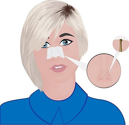 EPS 해외이미지 얼굴 일러스트 건강 가면 치료 검은색 스파 화장품 점 오픈 질병 피부 크림 피부관리 코 문제 여드름 돌봄 사춘기 염증 위생관리 트러블 해외202004 해외일러스트 컬러 의학 모션 관리 신체부위 뷰티 파일형식 벡터 이미지허브