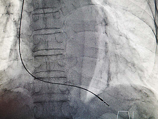 포토 JPG 해외이미지 실루엣 백그라운드 신체 해부 뼈 골격 엑스레이 실내 건강 병원 사람 사람없음 빛 약 스크린 진료 환자 의사 하트 긴급 구출 필름 관절염 갈비뼈 광 궤 돌봄 방사선 해외202004 해외포토 모양 의학 모션 촬영기법 내부 의료진 도움 질병 파일형식 이미지허브