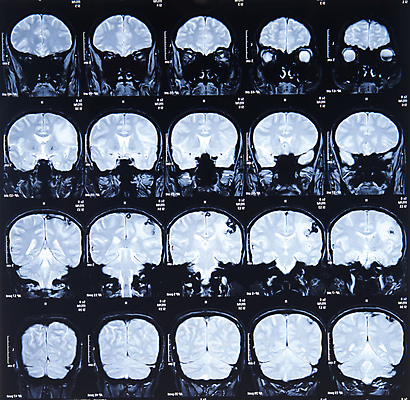 포토 JPG 해외이미지 신체 해부 엑스레이 건강 병원 사람 사람없음 치료 약 머리 고통 환자 광선 실험실 질병 필름 뇌 방사선 해골모형 해외202004 해외포토 감정 의학 실험 신체부위 모형 파일형식 이미지허브