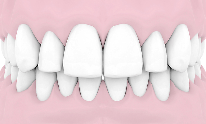 포토 JPG 해외이미지 모델 디자인 일러스트 건강 치과 사람없음 옆모습 약 금속 흰색 입 치아 오브젝트 치과의사 뿌리 외과 틀니 고립 돌봄 인공 철강 티타늄 해외202004 해외포토 뷰포인트 컬러 의학 모션 재질 병원 신체부위 의사 소화기관 원소 파일형식 이미지허브
