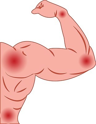 EPS 해외이미지 남자 스포츠 과학 백그라운드 신체 일러스트 해부 근육 건강 사람 치료 약 고통 의사 흰색 대접 질병 상처 하락 사건 손목 어깨 관절염 문제 팔 무거움 외과 테라피 돌봄 압축 연골 증상 팔꿈치 해외202004 해외일러스트 감정 컬러 컨셉 의학 모션 병원 신체부위 뷰티 의료진 무게 파일형식 벡터 이미지허브