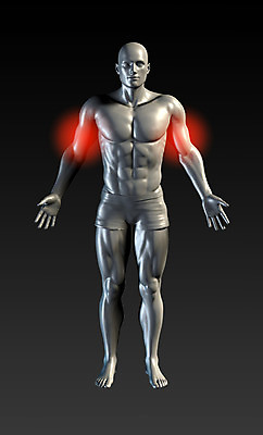 포토 JPG 해외이미지 신체 의학 근육 엑스레이 건강 사람없음 빛 고통 팔 근육통 물리치료 이두근 정형외과 치유 팔뚝 해외202004 해외포토 감정 병원 신체부위 치료 파일형식 이미지허브