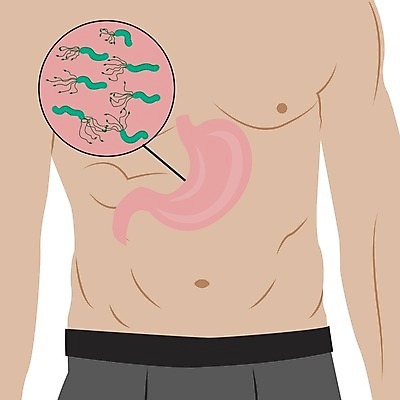 EPS 해외이미지 신체 일러스트 건강 내부 치료 약 오르간 바이러스 질병 냄새 감염 미생물 시스템 문제 박테리아 악취 위생관리 유황 증상 해외202004 해외일러스트 의학 생물 관리 건반악기 파일형식 벡터 이미지허브