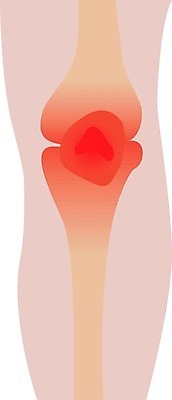 EPS 해외이미지 과학 컨셉 신체 일러스트 해부 건강 병원 사람 내부 치료 약 산책 손상 고통 환자 의사 대접 질병 상처 몸무게 위험 하락 사건 무릎 문제 무거움 테라피 돌봄 연골 증상 헬프 해외202004 해외일러스트 감정 의학 모션 휴식 신체부위 뷰티 의료진 도움 무게 파일형식 벡터 직업 이미지허브