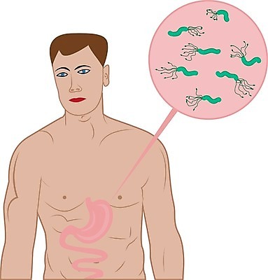 EPS 해외이미지 일러스트 건강 내부 치료 약 오르간 바이러스 질병 냄새 감염 미생물 가스 시스템 문제 박테리아 악취 나쁜 위생관리 유황 증상 치료제 해외202004 해외일러스트 의학 생물 관리 건반악기 파일형식 벡터 이미지허브