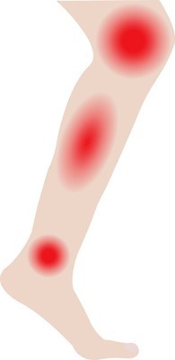 EPS 해외이미지 신체 일러스트 양말 건강 사람 치료 고통 의사 대접 변화 질병 몸무게 위험 큼 하락 사건 비만 피부 함선 문제 무거움 테라피 발목 파산 돌봄 압축 양발 증상 해외202004 해외일러스트 감정 컨셉 의학 모션 발 신체부위 금융 뷰티 의료진 배 무게 크기 몸매 선박 파일형식 벡터 직업 수상교통 경제 교통수단 교통 이미지허브