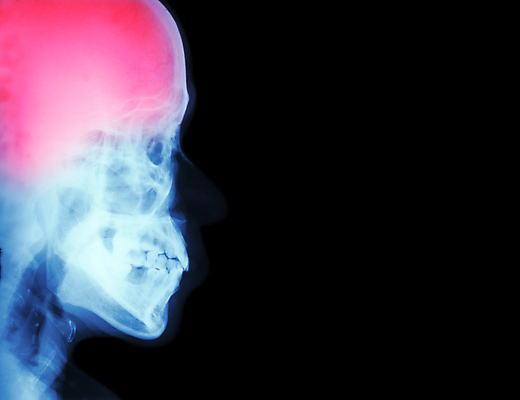 포토 JPG 해외이미지 응시 얼굴 해부 뼈 골격 엑스레이 건강 병원 사람 사람없음 옆모습 약 머리 고통 환자 의사 광선 질병 X 사건 뇌 두통 돌봄 방사선 염증 타격 편두통 해골모형 해외202004 해외포토 알파벳 시선 감정 뷰포인트 의학 모션 신체부위 모형 의료진 파일형식 이미지허브